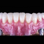 Innovations In Modern Dentistry: What's New?